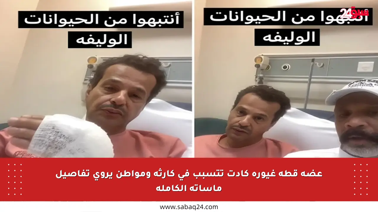 عضة قطة غيورة كادت تتسبب في كارثة ومواطن يروي تفاصيل مأساته الكاملة